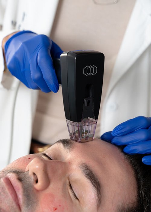 Medicina estética rellenos